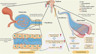 High-cutoff hemodialysis in multiple myeloma patients with acute kidney injury